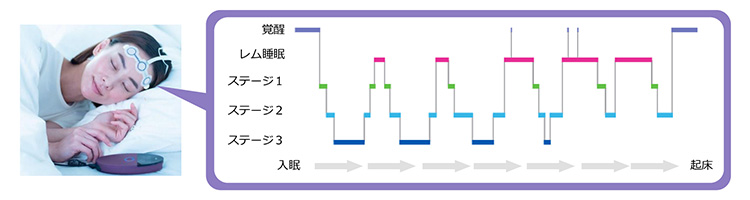 脳波グラフ